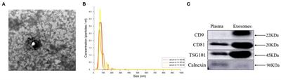 Obstructive Sleep Apnea Impacts Cardiac Function in Dilated Cardiomyopathy Patients Through Circulating Exosomes